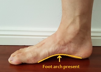 how-to-fix-flat-feet-1.jpg