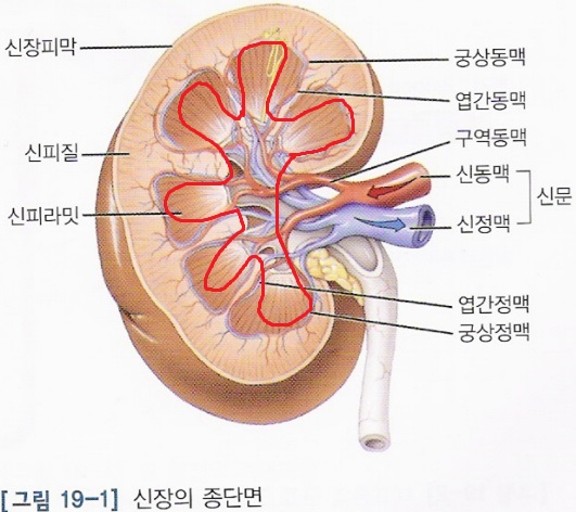 약혐) 요로결석의 끝판왕 [녹각석]_3.jpg