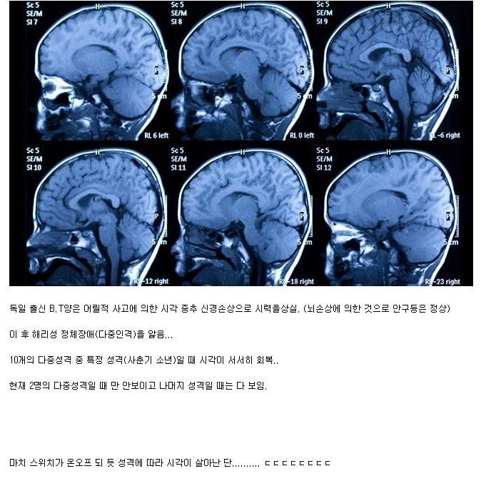인간 뇌의 미스테리.jpg