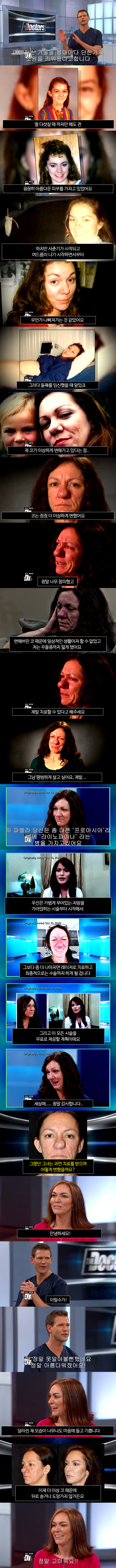 코 때문에 숨어 살던 여자 . jpg_1.jpg