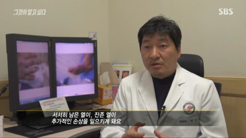 안아키식 화상 치료법_21.png