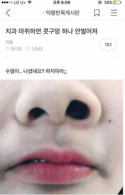 여초카페 치과마취 후기.jpg_1.jpg