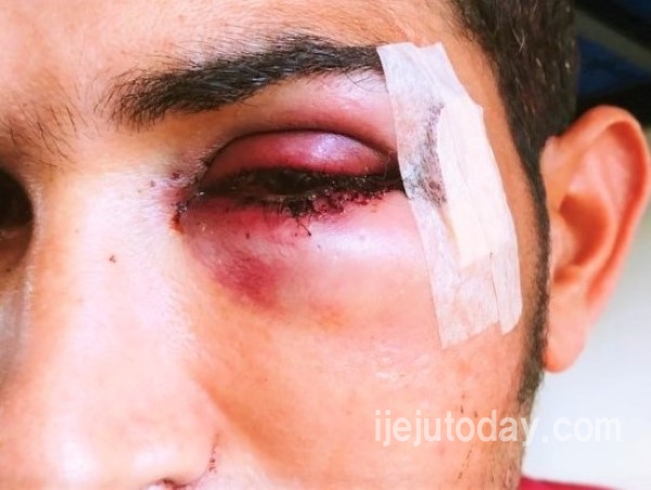 예멘인 2명, 한국인들에게 집단 폭행당해_1.jpg