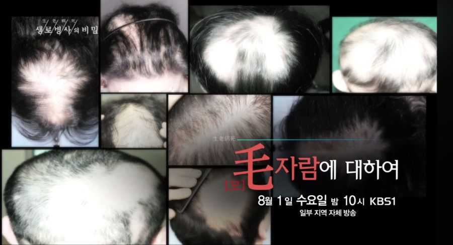 KBS의 선전포고_1.png