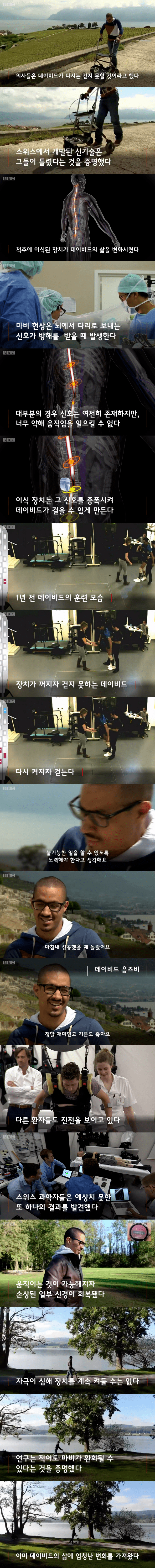 하반신 마비 환자들의 희소식_1.png