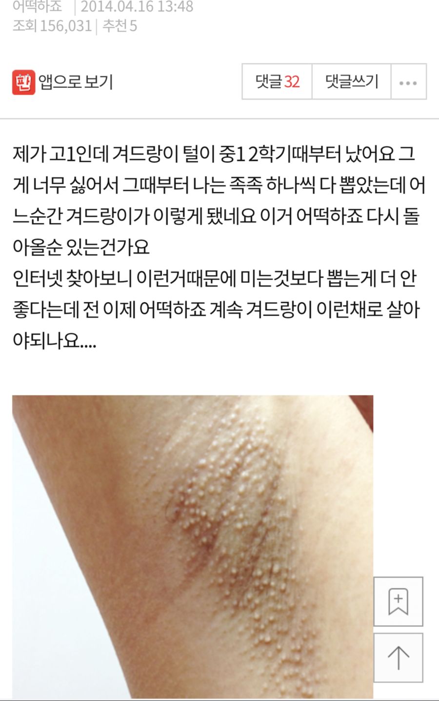 (혐) 겨털 뽑은 네이트판의 최후.jgp_1.jpg