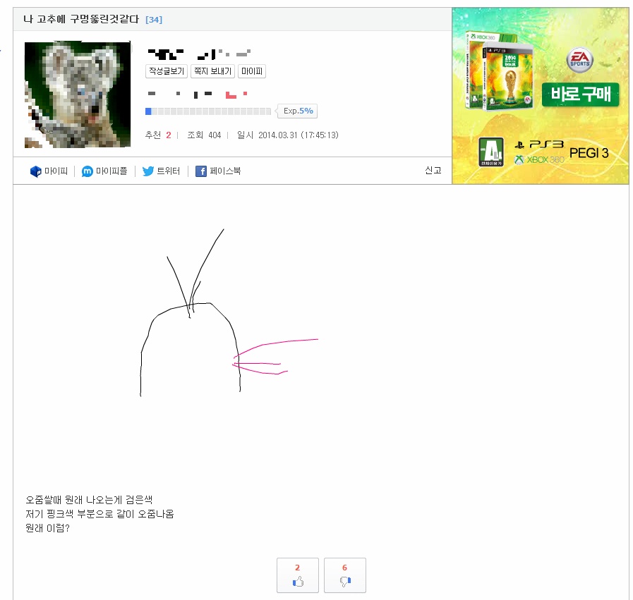 익스트림한 어느 사이트_5.jpg