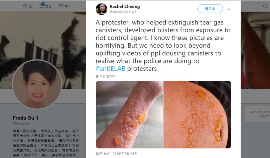 [혐주의]미친 중국 공산당 새끼들 - 홍콩 시위 진압에 생화학무기?_2.png