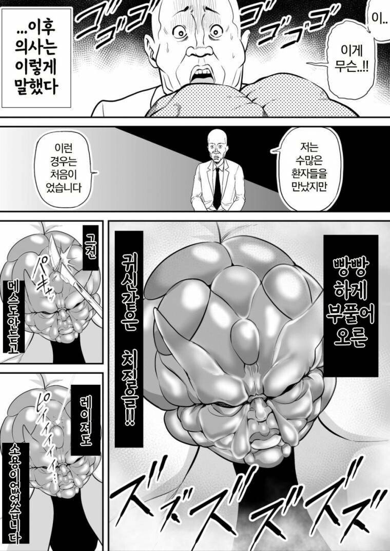 한마 유지로식 치질치료_2.jpg