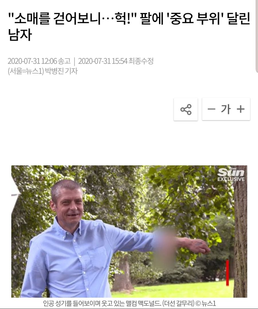 팔에 인공 쥬지를 달고 다니는 남자 ㄷㄷㄷ_1.jpg