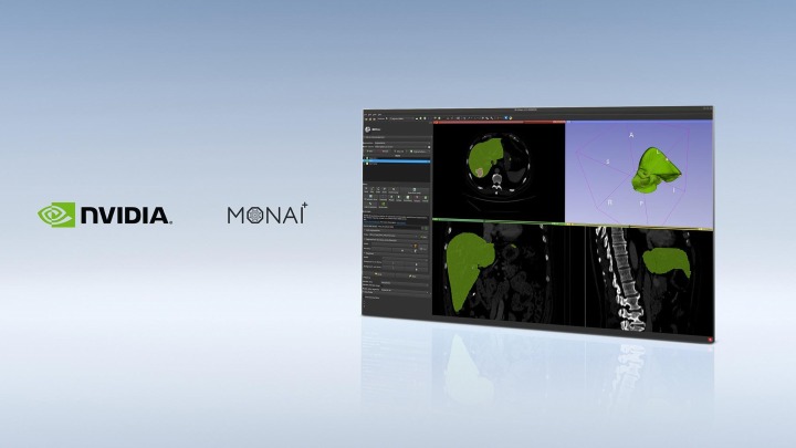 [이미지] 엔비디아, MONAI 이미징 프레임워크로 헬스케어 분야 AI 혁신 가속화.jpg