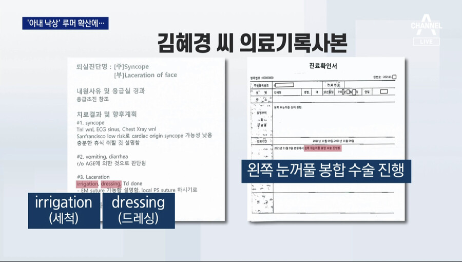 혜경궁이 일시적 기억 소멸로 찢어진 곳이… | 정치유머 게시판 혜경궁이 일시적 기억 소멸로 찢어진 곳이… | 정치유머 게시판 | 루리웹