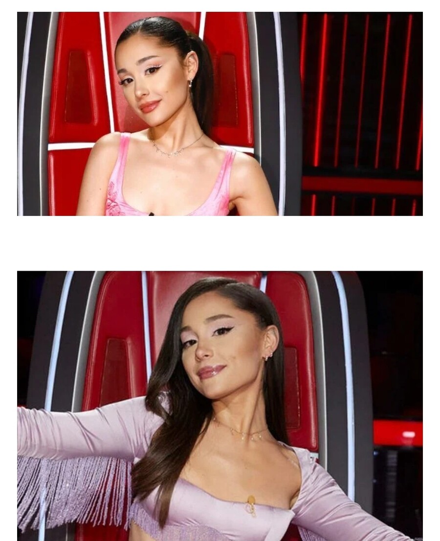 한국에서 성형한 미국팝 여가수_2.jpg