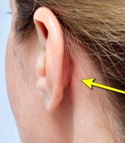 Q) 귀 뒤쪽에, 손으로 짜니까 냄새.. 나는데 뭐냐 이거.._1.jpg