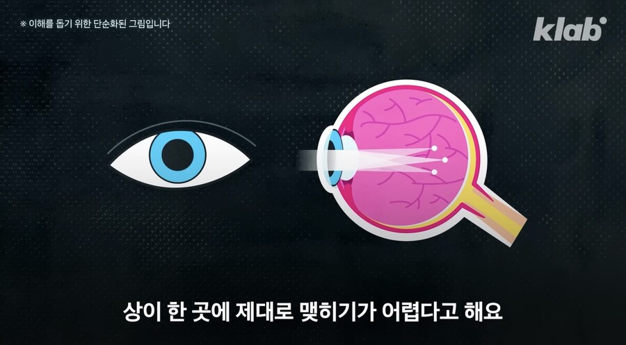 다크 모드 쓰면 눈 건강이 안 좋아진다?.jpg_23.jpeg
