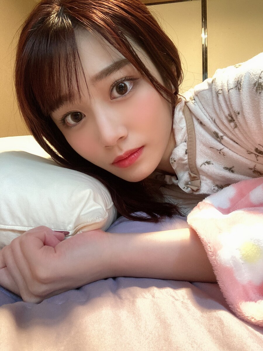 성형수술 잘 된 케이스 끝판왕 배우.PNG_3.jpg