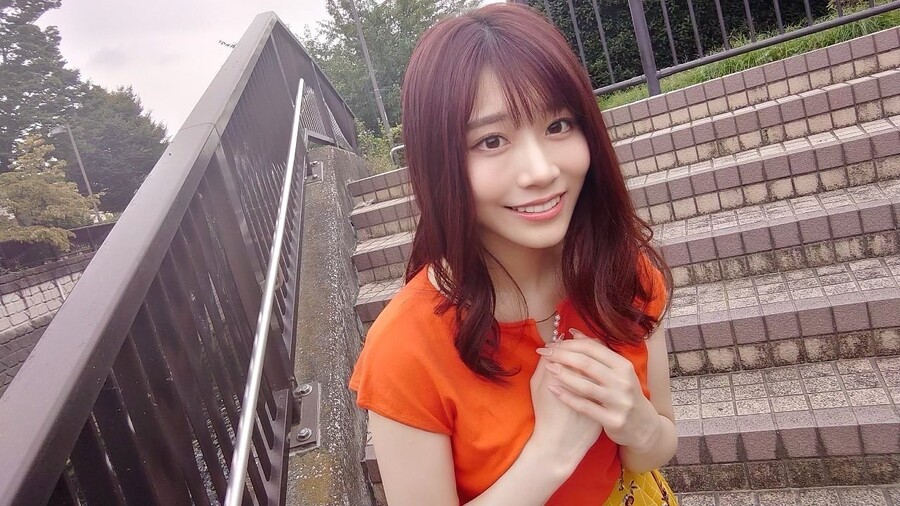 성형수술 잘 된 케이스 끝판왕 배우.PNG_5.jpg