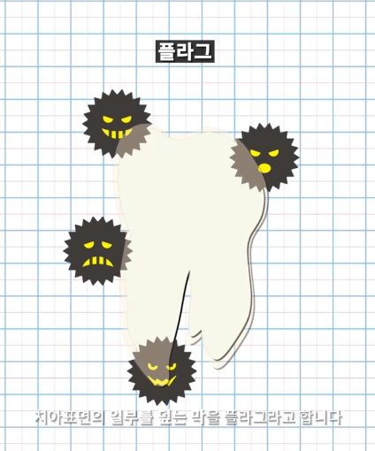 한달동안 이를 닦지 않으면 생기는 일_4.png