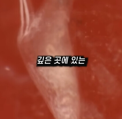 [혐] 딸기에 있는 하얀 털의 비밀_8.jpg