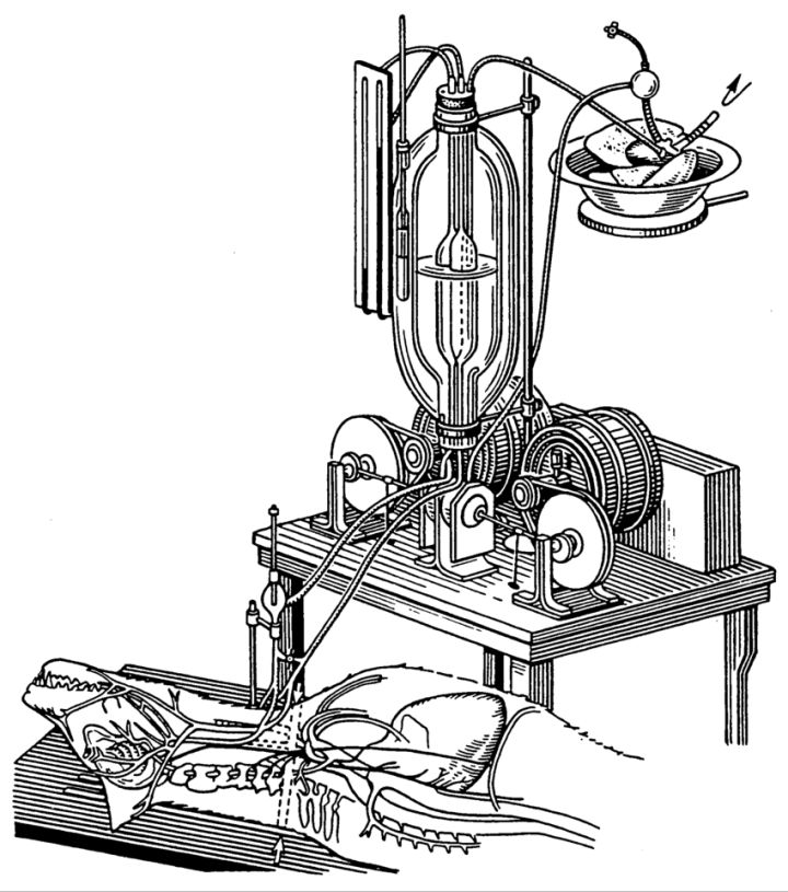 Bruchonenkos-autojector-with-donor-lungs-for-blood-oxygenation-Reprinted-from-reference.png