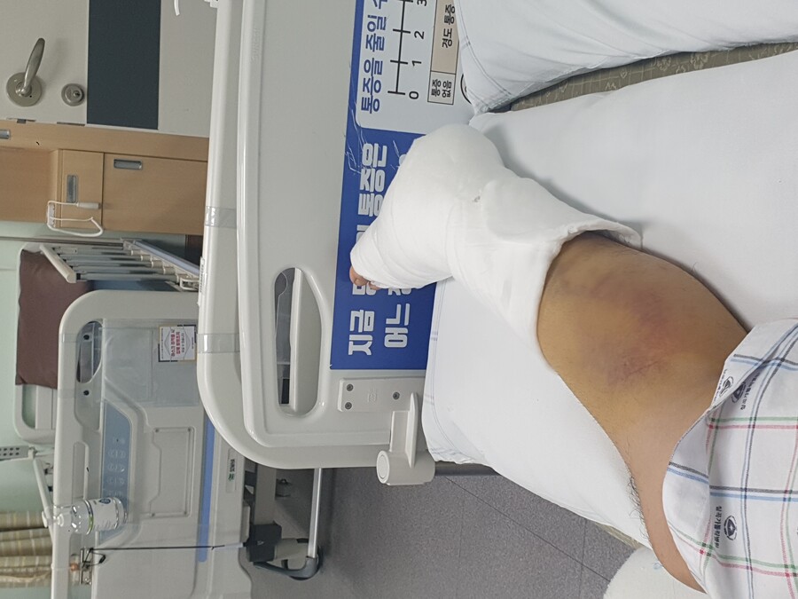 혐 스압 )내 다리 상태가 유머_3.jpg