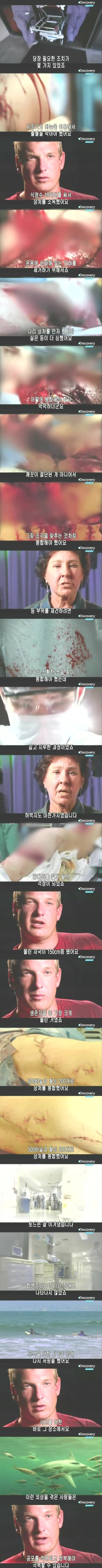 [극혐] 상어한테 물린 사람.jpg_8.jpg