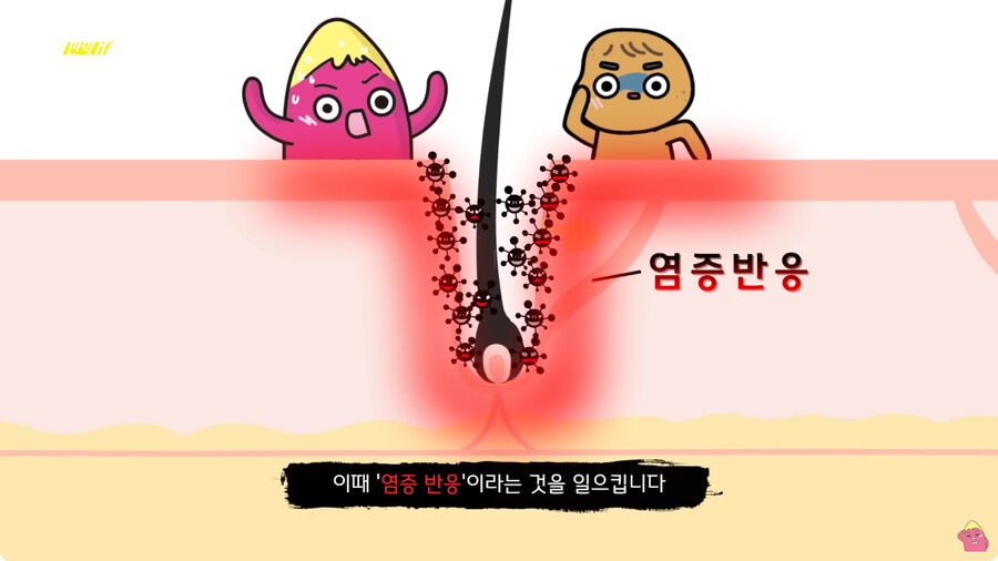 [스압] 한달 동안 머리를 감지 않으면 생기는 일.jpg_40.png