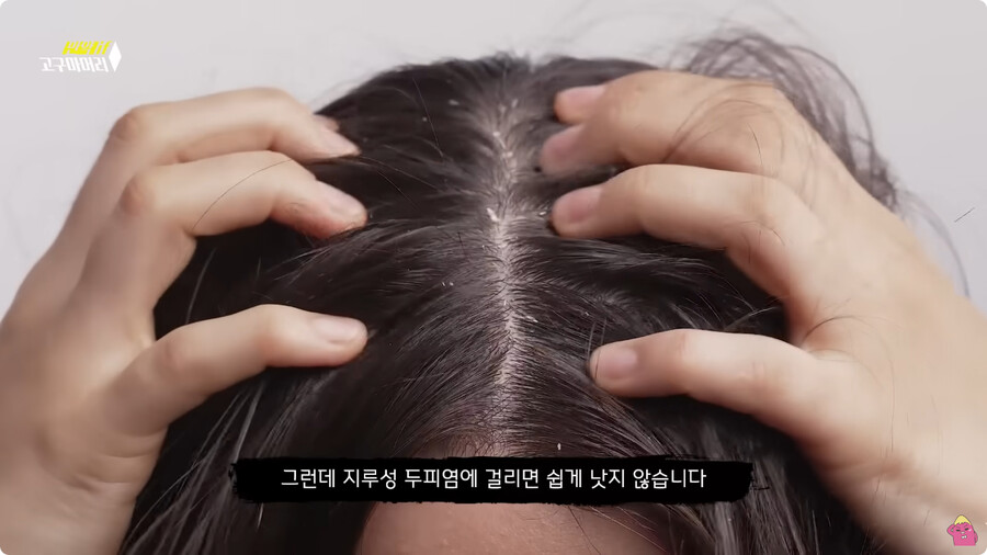 [스압] 한달 동안 머리를 감지 않으면 생기는 일.jpg_52.jpg