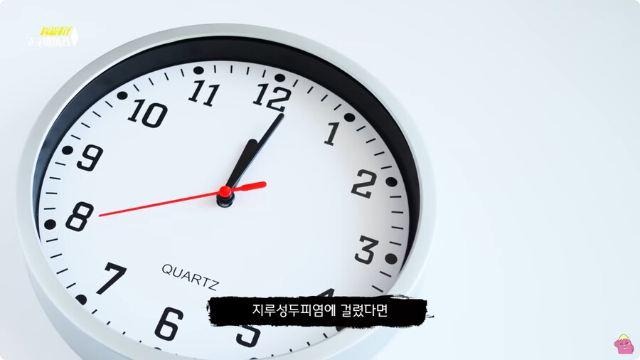 [스압] 한달 동안 머리를 감지 않으면 생기는 일.jpg_66.jpg