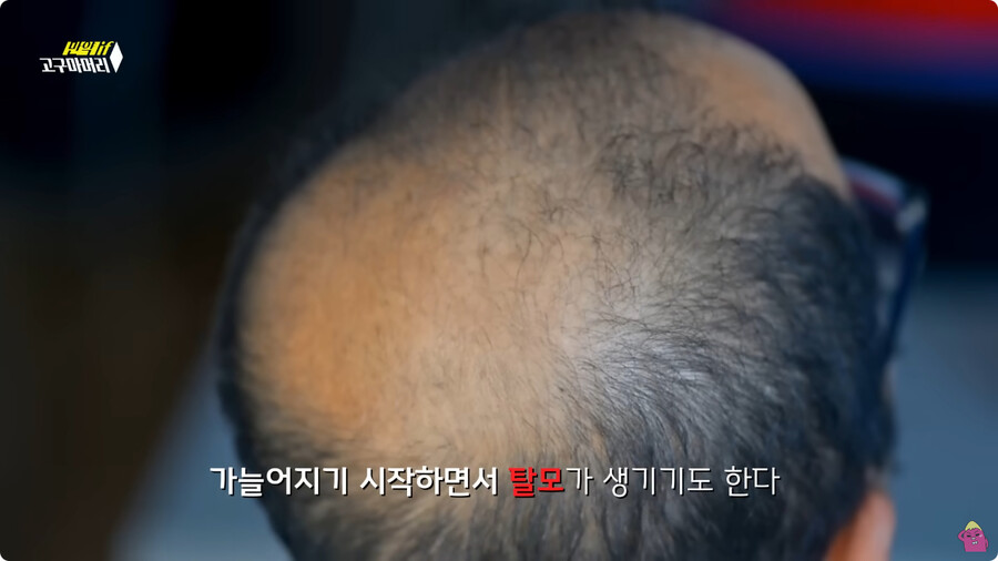 [스압] 한달 동안 머리를 감지 않으면 생기는 일.jpg_73.jpg