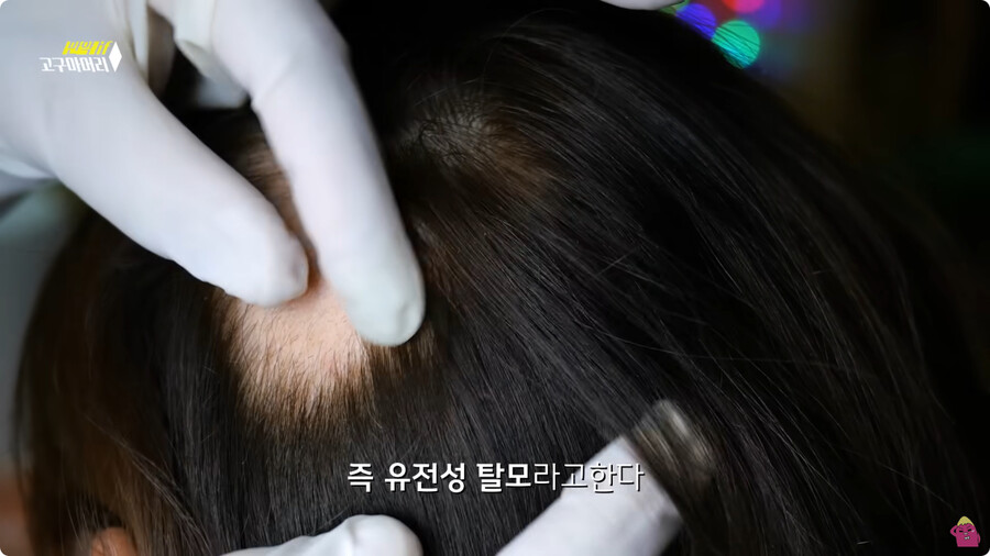 [스압] 한달 동안 머리를 감지 않으면 생기는 일.jpg_83.jpg