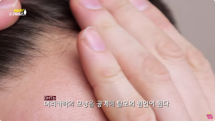 [스압] 한달 동안 머리를 감지 않으면 생기는 일.jpg_87.jpg