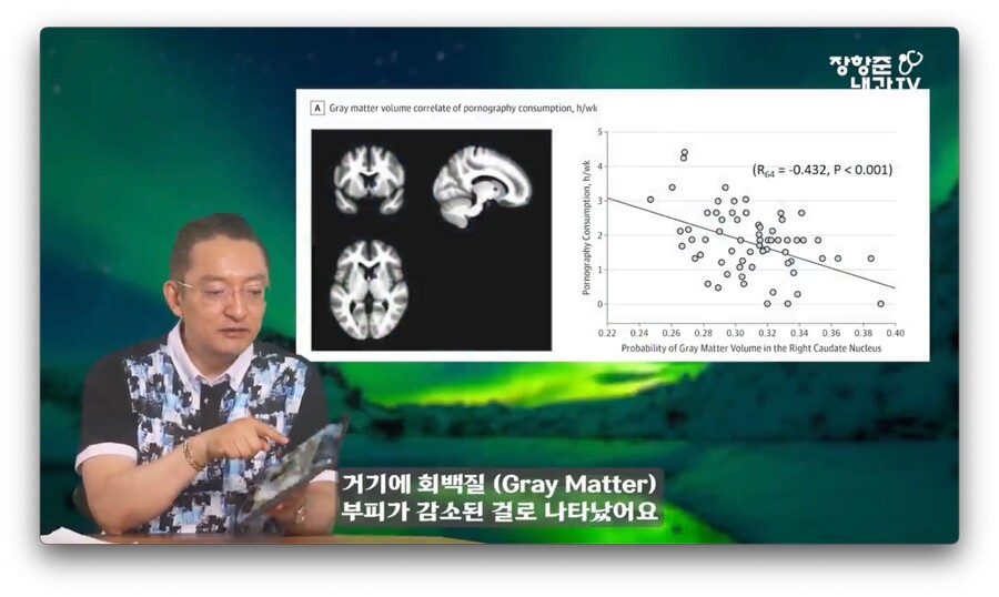 야동 시청시간에 비례해서 뇌가 쪼그라든다는 연구 결과.jpg_6.jpeg