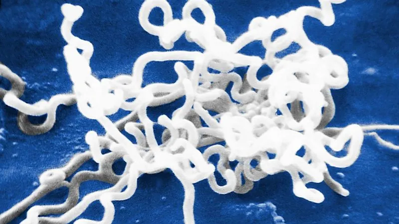 세계 각국에서 매독을 부르던 호칭_1.webp