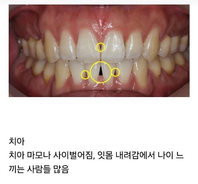 의외로 나이가 실감되는 신체부위_1.jpg