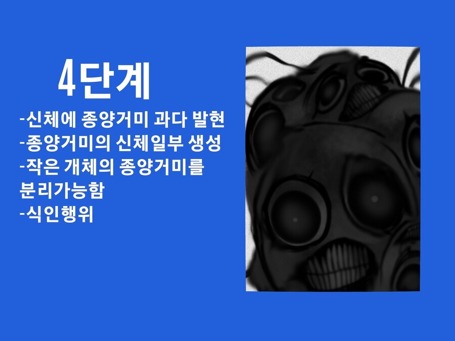 공포)종양거미분열증 안내사항_8.jpg