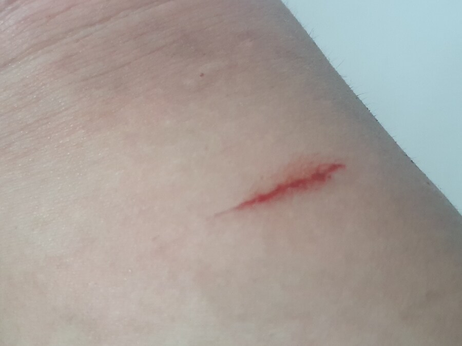 엄마없는애 포획성공_2.jpg