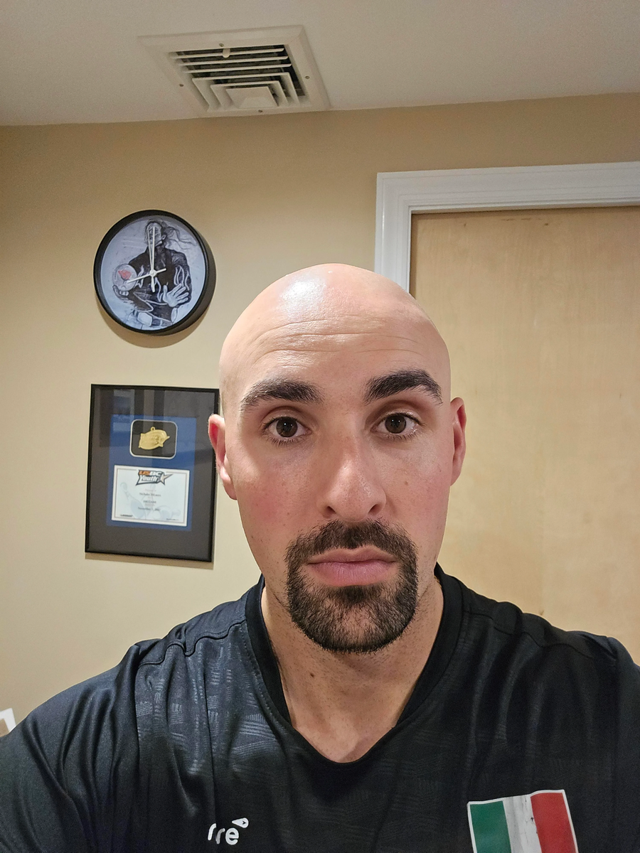 외국에 머리민 사람들이 많은 이유.jpg_4.webp