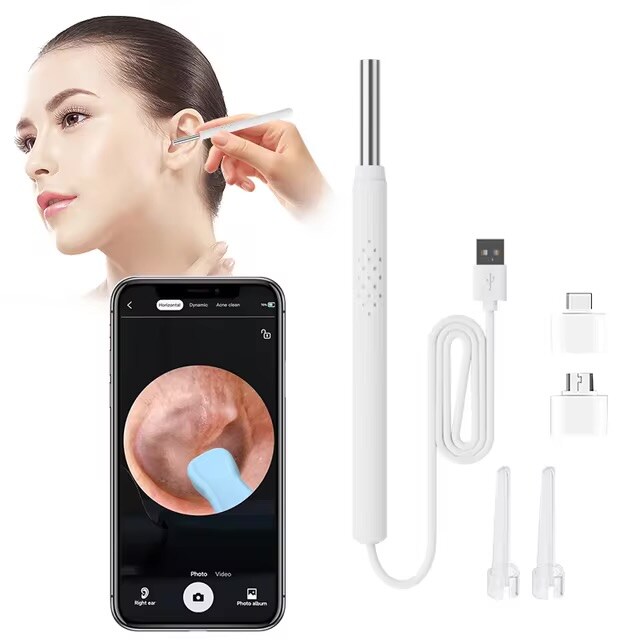 안드로이드 PC용 USB 귀 검이경($3.99/무료)_1.jpg