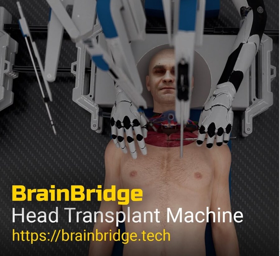 약혐) 한때 전세계 커뮤니티에서 난리 났었던 머리 교체 스타트업_2.jpg