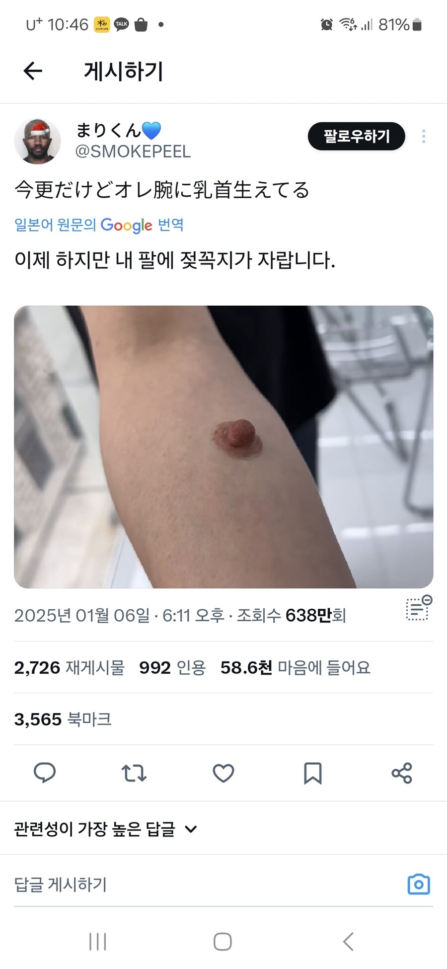 젖 꼭 지 노출_1.jpg
