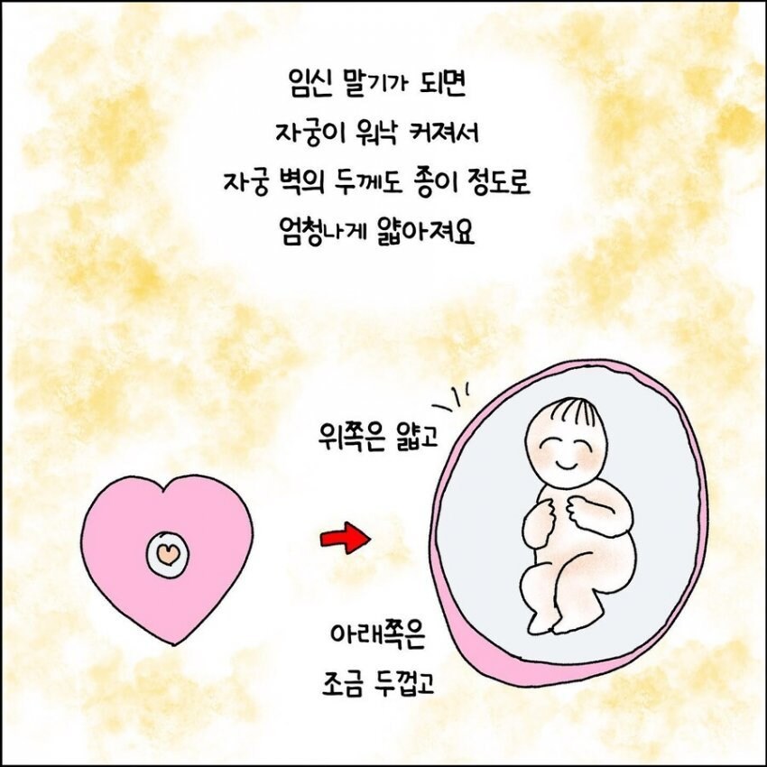 산부인과에서 출산 중 자궁이 파열되는 만화.manhwa_2.jpg