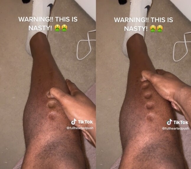 진짜 살이 쭉쭉 빠지고 있다는 신호_6.jpg