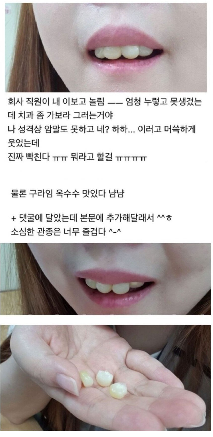 회사 직원이 내 이 보고 놀림_1.jpg