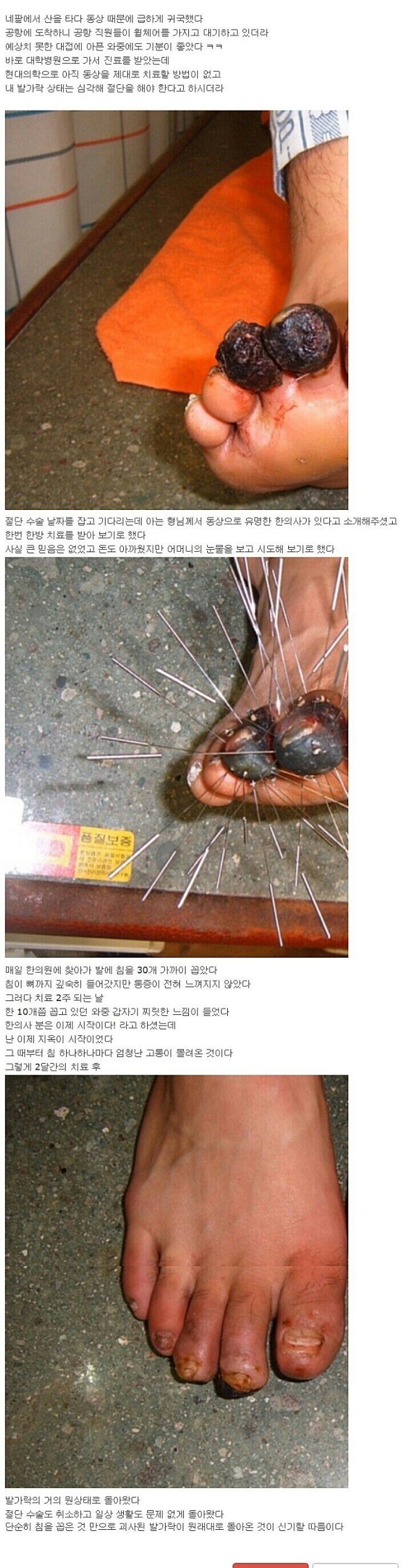 (혐주의) 한 때 난리났던 한의학 레전드 후기_1.jpg