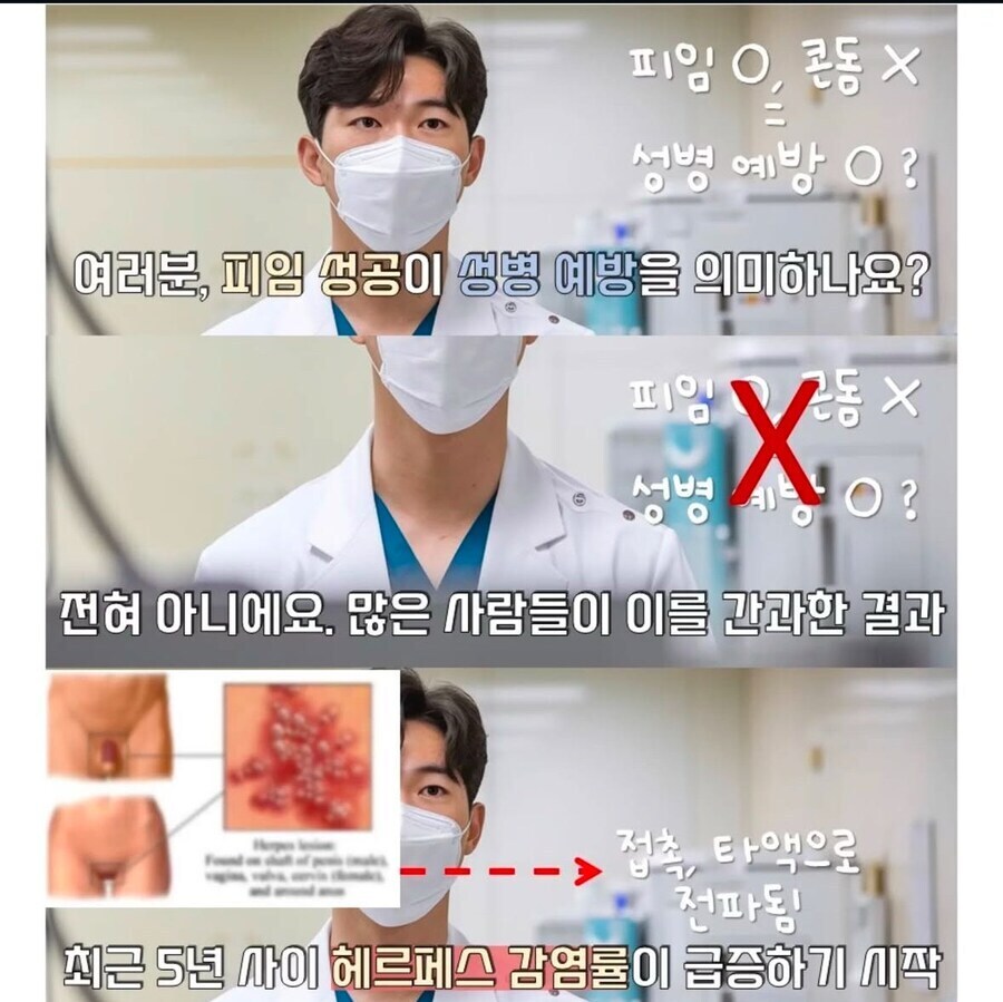 피임 기술이 좋아지자 생기는 부작용.jpg_2.jpg