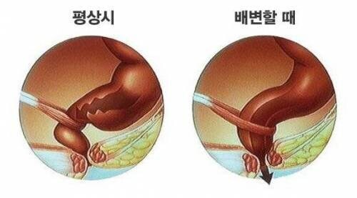 의외로 매우 중요한 근육.jpg_1.jpg
