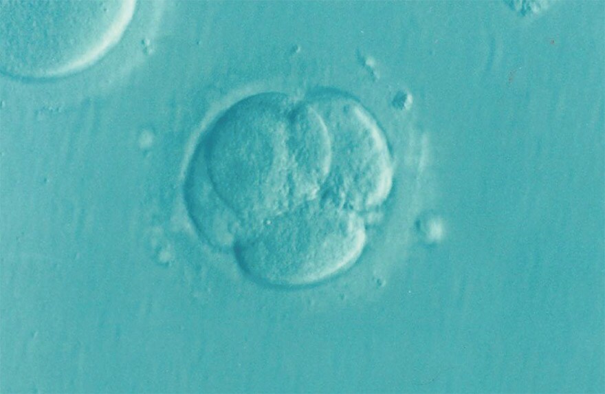 SF) 미래 인류의 손쉬운 우주개척_13.png