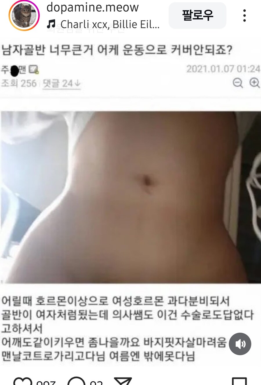 여성호르몬이 많았던 디시인_1.jpg