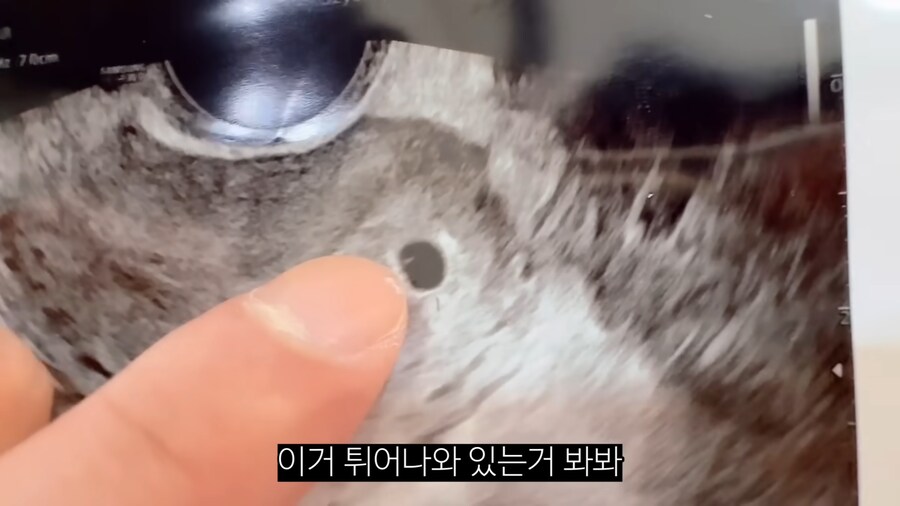 남편이 무족건 납짝 엎드리면서 사과하게 된 이유류 甲_18.png